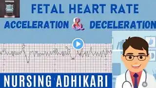 DECELERATION OF FETAL HEART RATE (Early , Late and variable), Acceleration ।। Mnemonic VEAL CHOP ।।