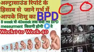 foetal BPD parameter measurements week by week in ultrasound/what is BPD