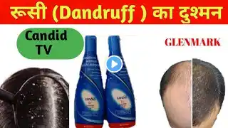 Candid TV Suspension Review and Uses |Best Anti - Dandruff Candid TV....…..