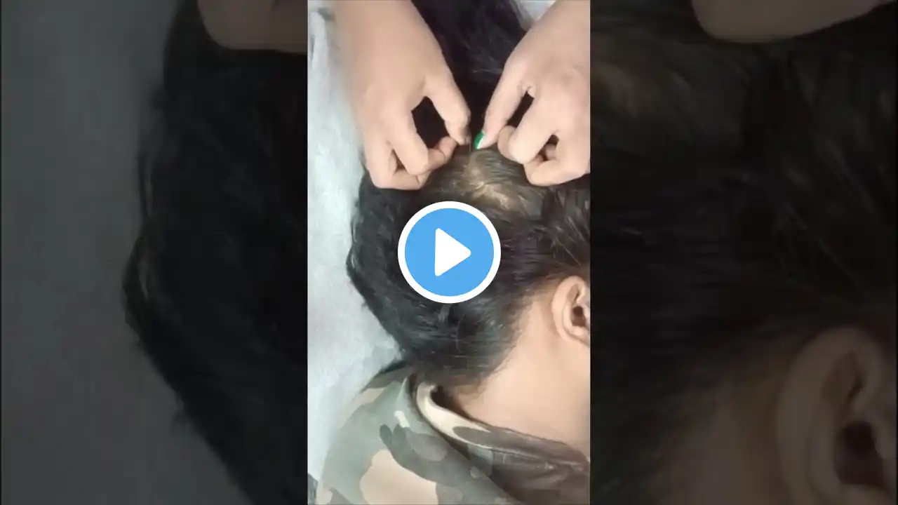 Relaxation and Scalp Check ASMR #asmr #hair #sleep #shortsfeed #shorts