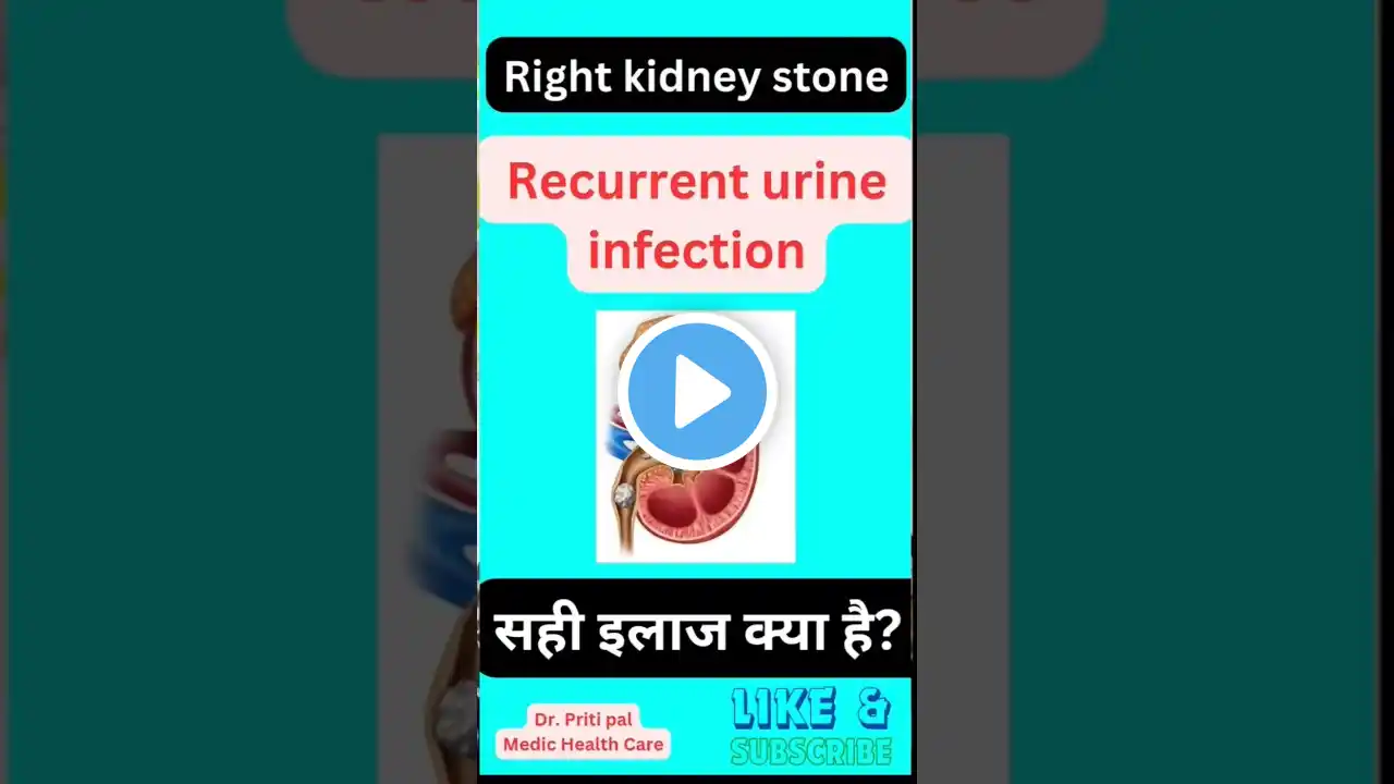 kidney stone ( right side) | best homeopathic treatment | recurrent uti | homeopathy short