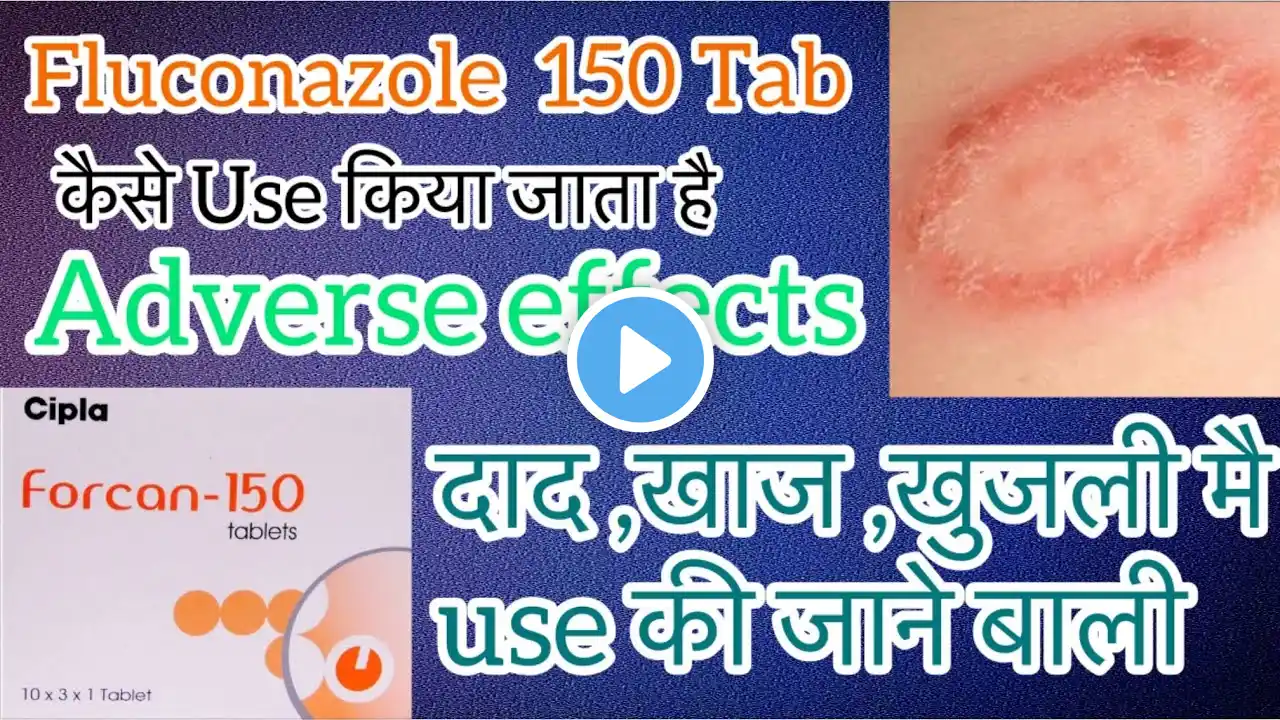 Tab Fluconazole tab / Fluka 150mg , Forcan 200mg uses Adverse Effects, Ringworm infections,