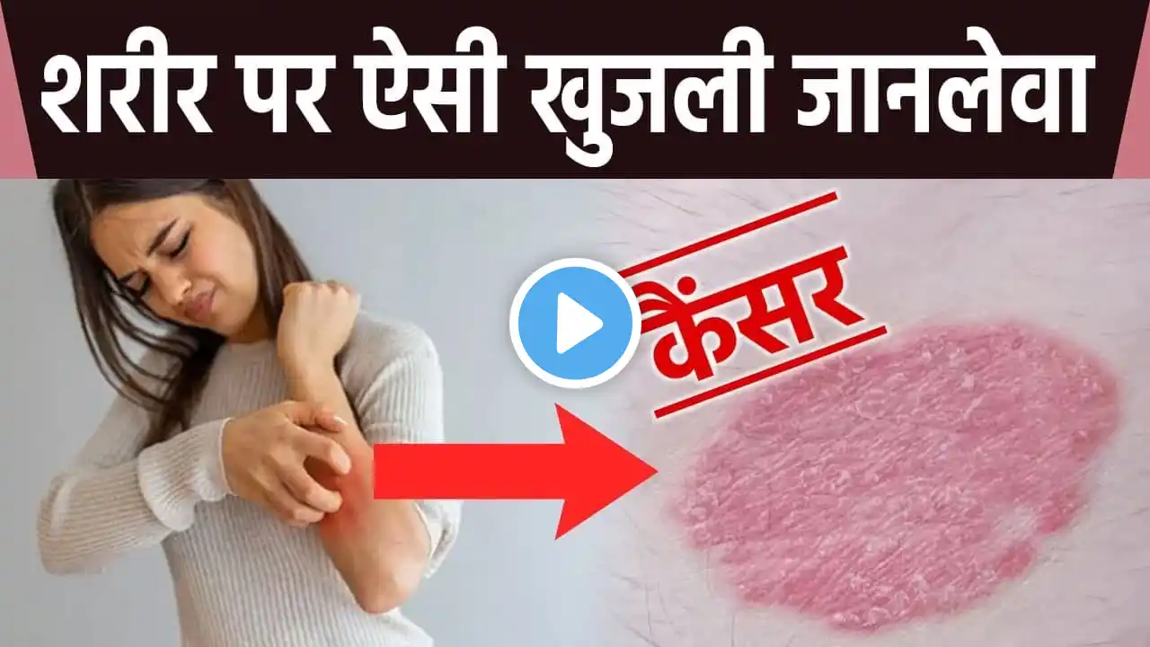 शरीर पर ऐसी खुजली होना जानलेवा Cancer ke Symptoms, जाने कारण और बचाव | Boldsky