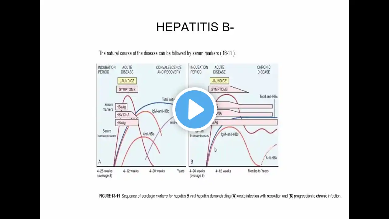 Infectious Diseases | Pathophysiology of Viral Hepatitis