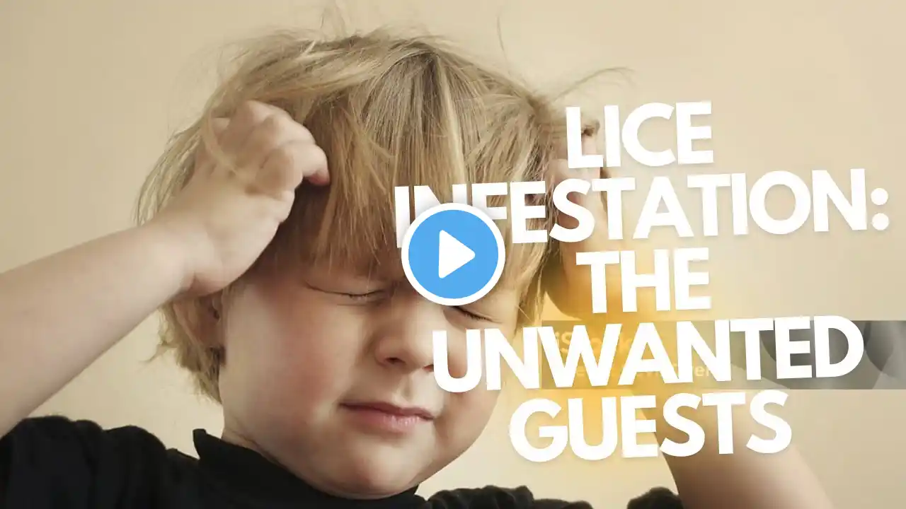 why and how lices come to hair Lice Infestation |The Unwanted Guests