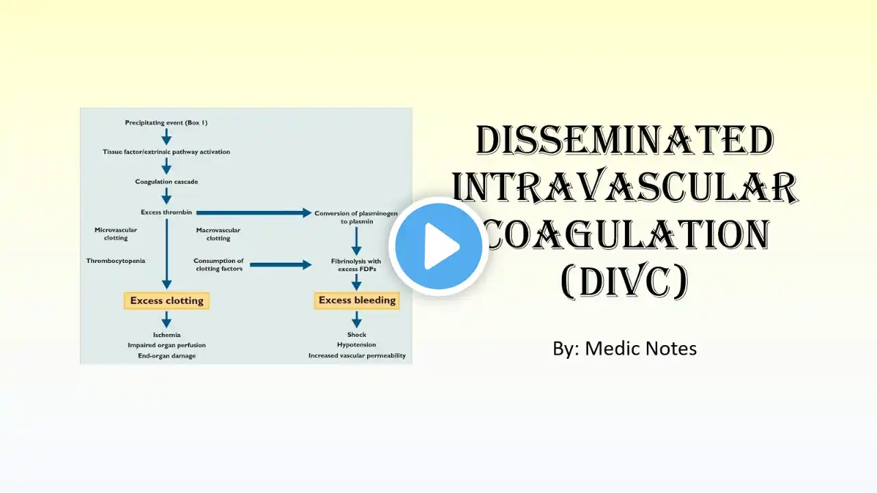 Disseminated intravascular coagulation (DIVC) - causes, symptoms, investigations, treatment