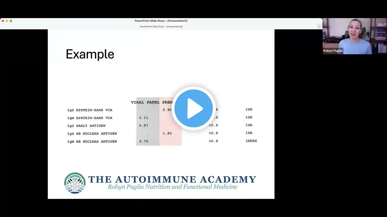 How to interpret Epstein Barr Virus (EBV) test results.