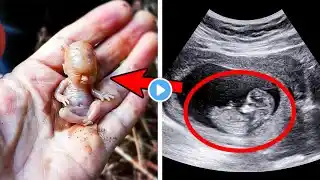 MOST BIZARRE Babies That Were Born Different