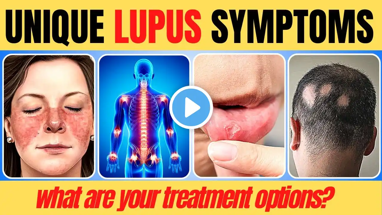 Important symptoms to look out that is unique to Lupus | Doc Cherry