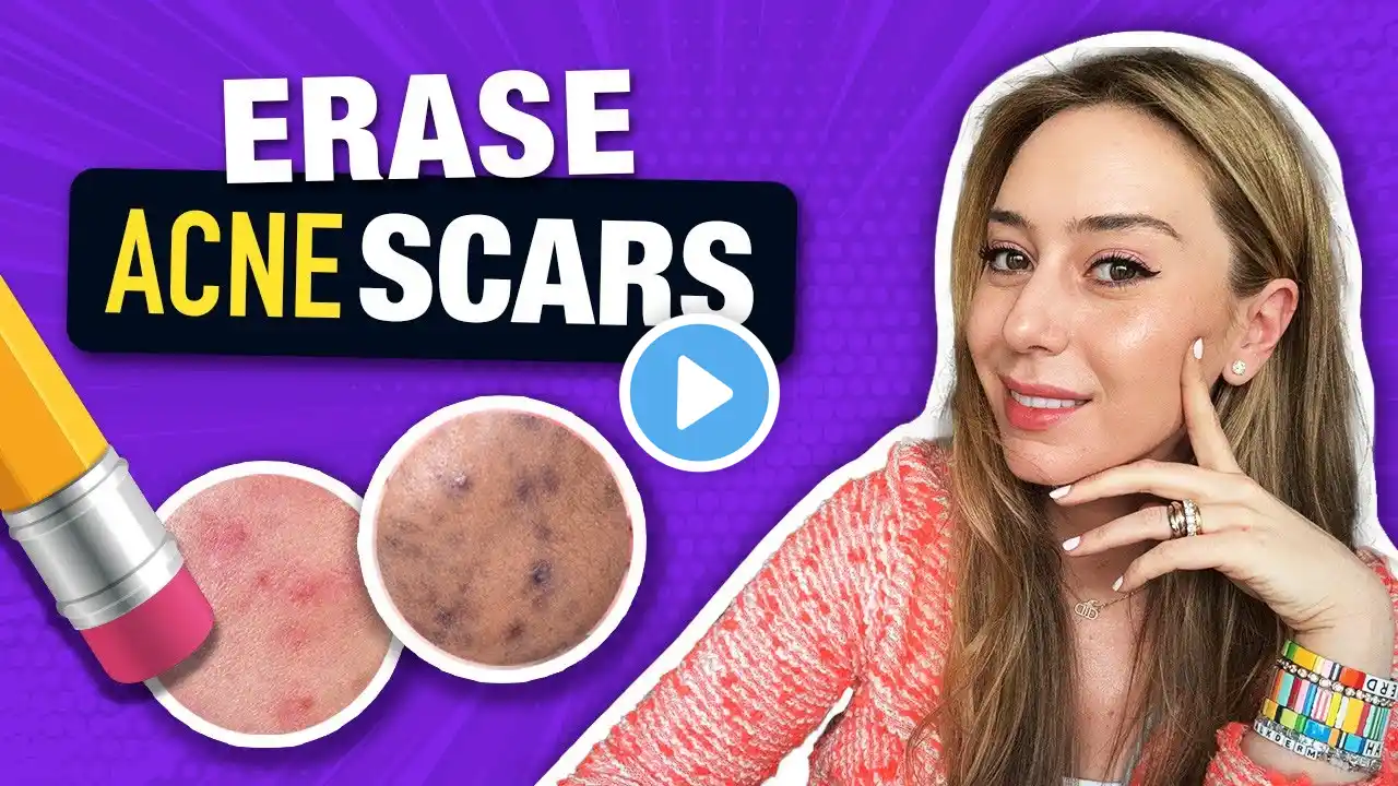 How to Treat & Fade Acne Scars like a Dermatologist! | Dr. Shereene Idriss