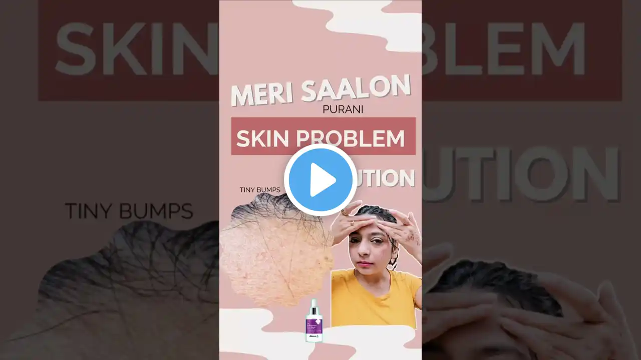 Meri Saalon Purani Skin Problem Ka Solution! 🔥 | The Derma Co Salicylic Acid Serum Review #shorts