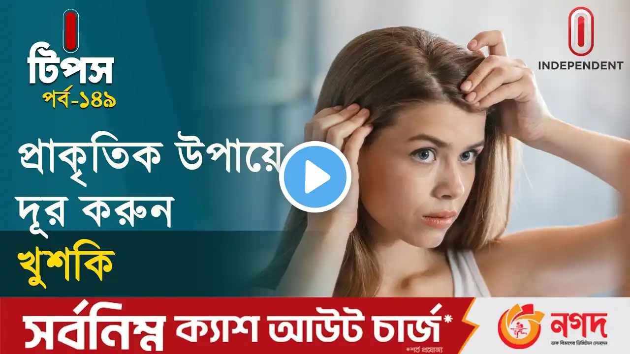 খুশকি দূর করার ঘরোয়া ৬ উপায় | Dandruff solution | I tips | Independent TV |