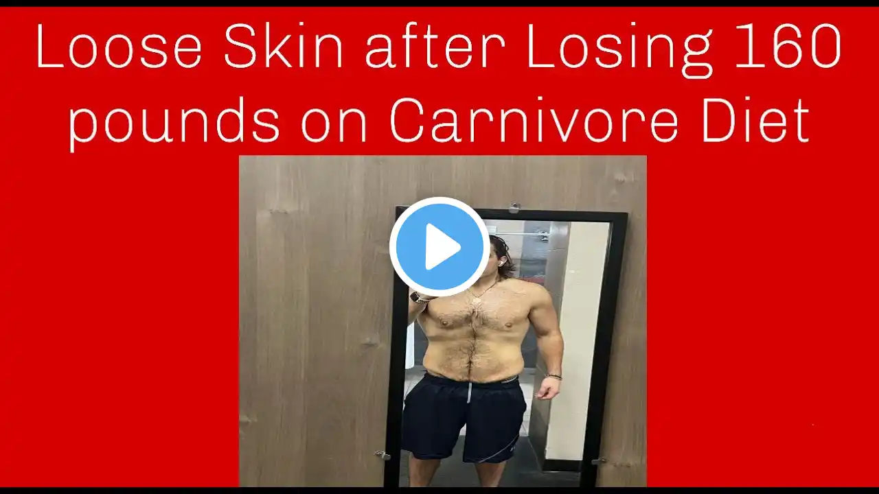 Loose skin after losing 165 pounds on Carnivore and Intermittent Fasting