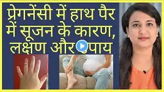 प्रेगनेंसी में हाथ, पैरों में सूजन । swelling in pregnancy। pregnancy care in Hindi।