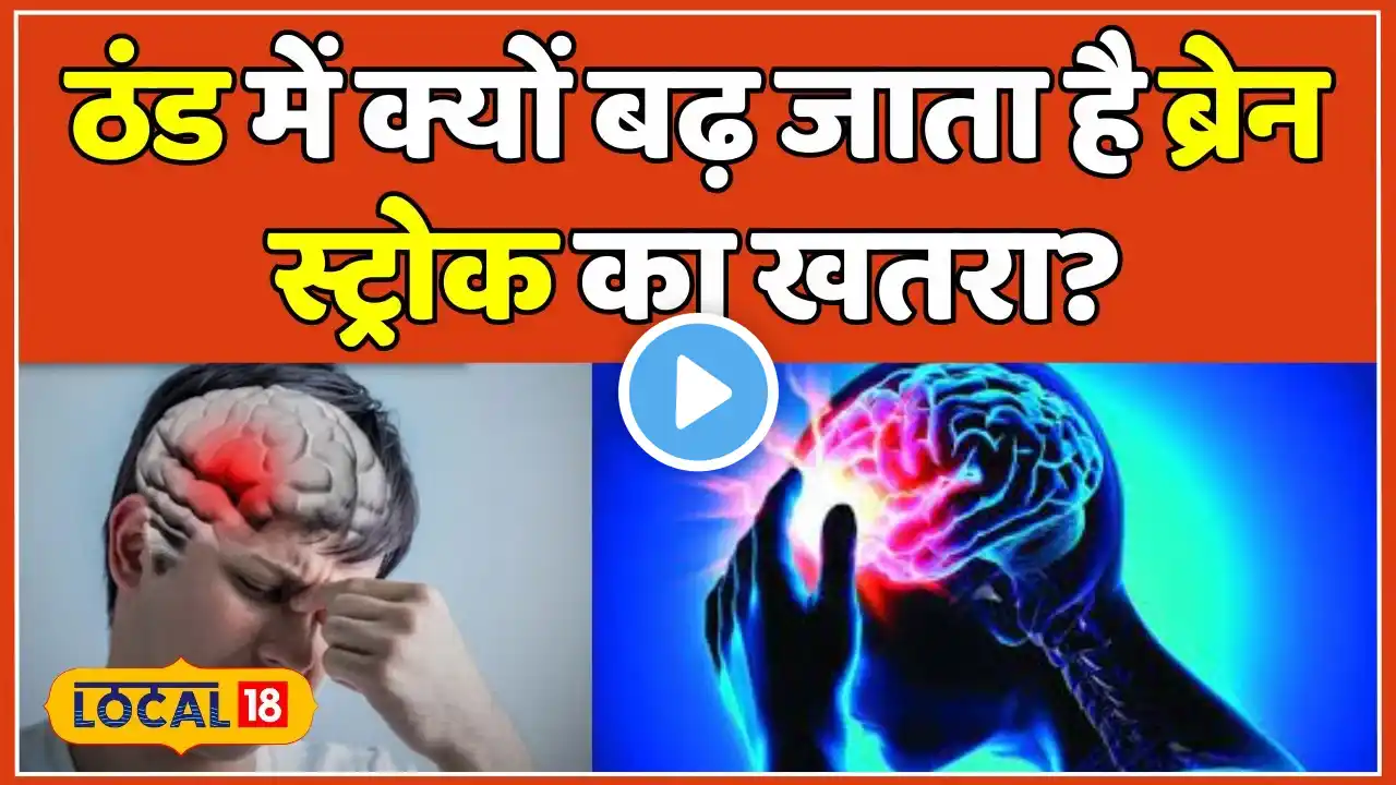 Brain Stroke: सर्दियों में बढ़ जाते हैं ब्रेन स्ट्रोक के मामले? Expert से जाने खास बाते | #local18