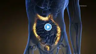 Colorectal Cancer Awareness | Healthwatch 16