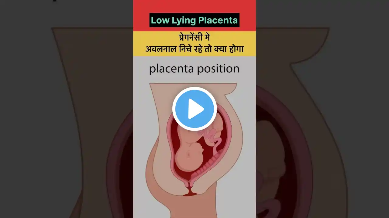 प्रेगनेंसी मे low lying placenta क्या होता है #pregnancy #lowlyingplacenta #womenshealth #shorts