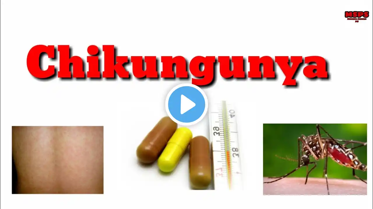 Chikungunya disease/ चिकेनगुनिया बीमारी किया होती है? full explain in hindi