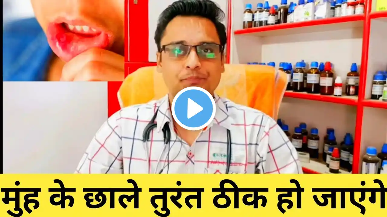 mouth ulcers, मुंह के छाले तुरंत ठीक हो जाएंगे, mouth ulcer home treatment, recurrent mouth ulcers