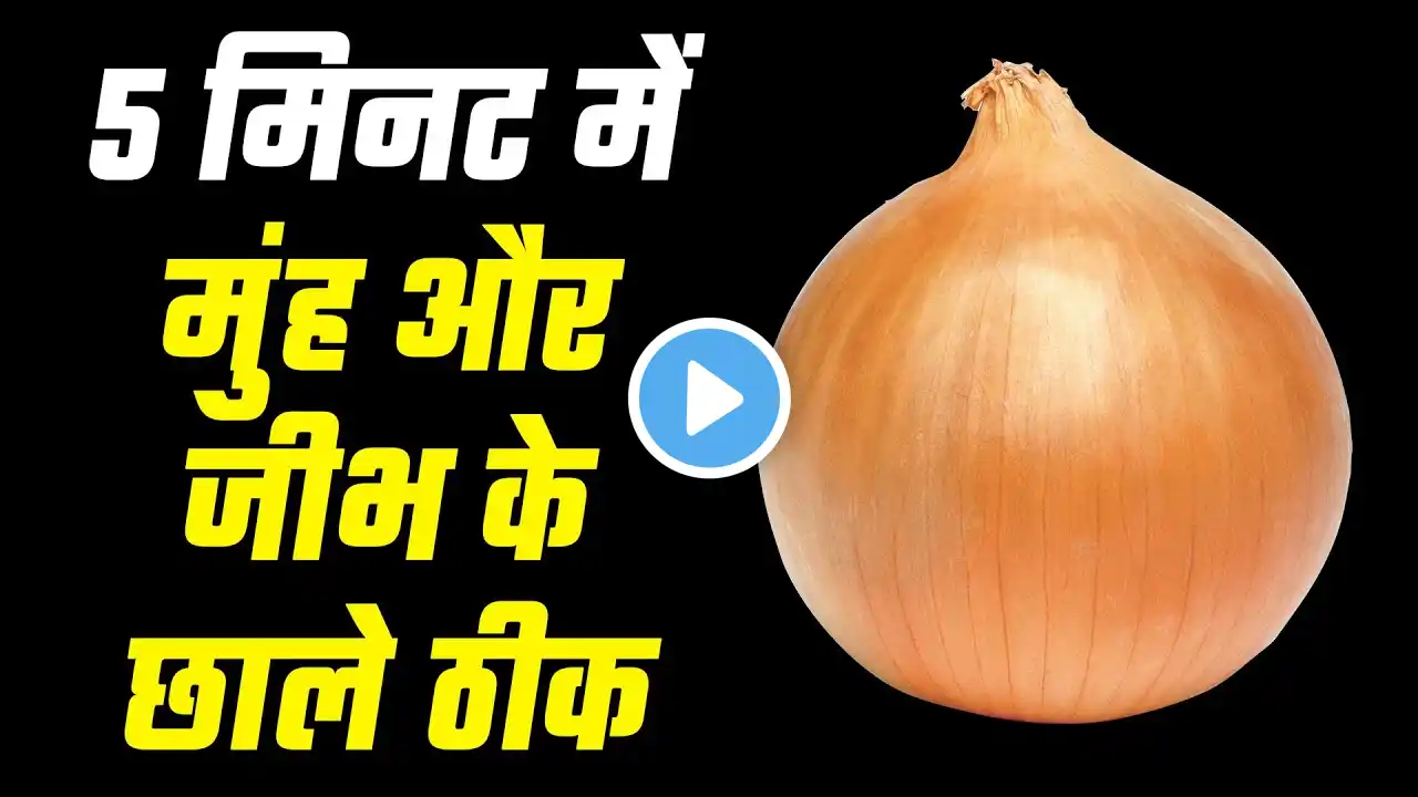 5 मिनट में मुँह और जीभ का छाले ठीक करने के उपाय | How to get rid of Mouth and Tounge ulcers