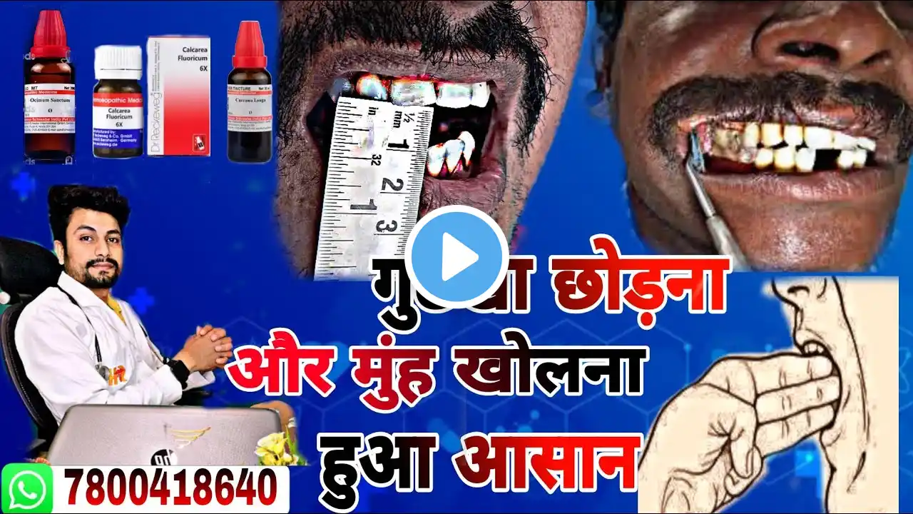 गुटखा छोड़ना और मुंह खोलना हुआ आसान ॥ OSMF Treatement ॥ Oral submucosa Fibrosis Treatment ॥ LockJaw