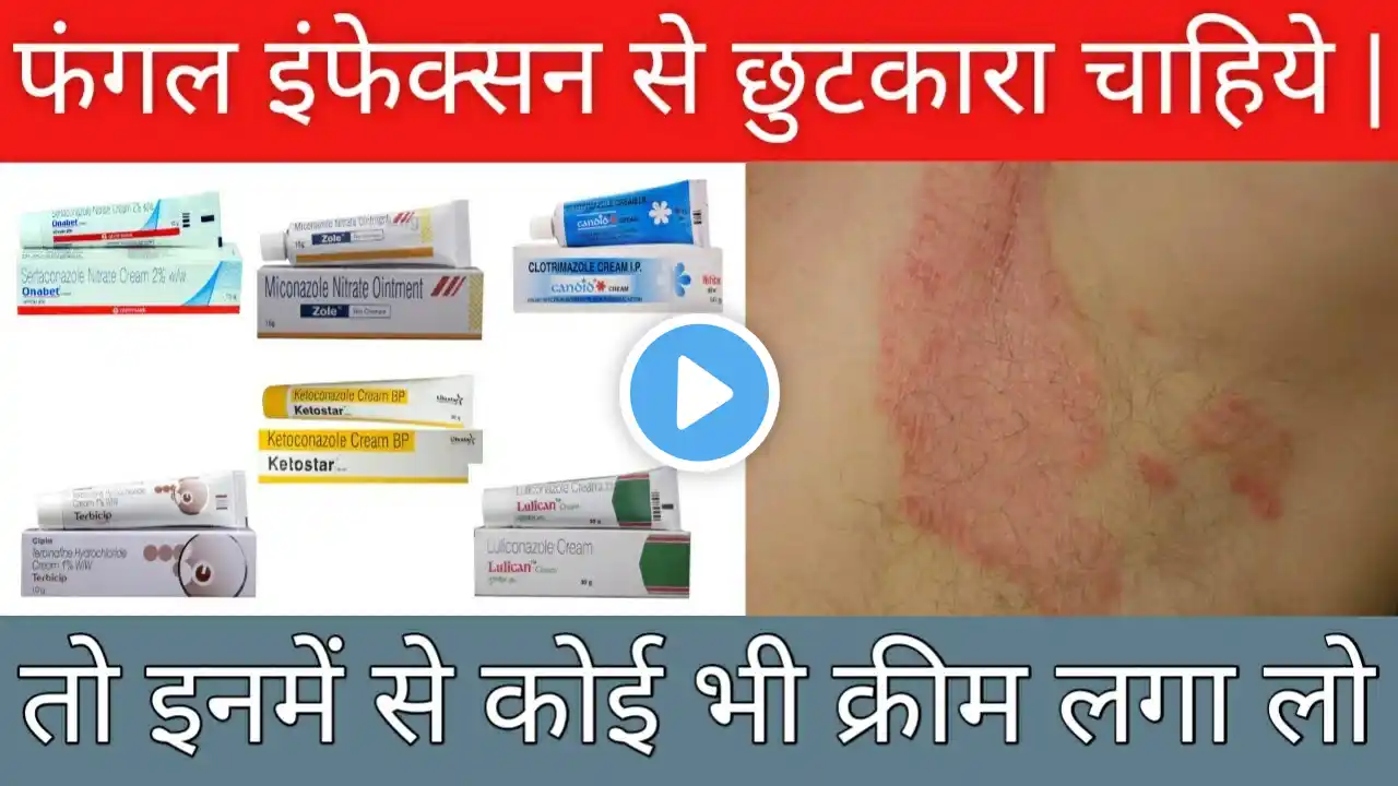 fungal infection Treatment | Daad ki best medicine cream | Fungal infection cream | daad ka ilaj
