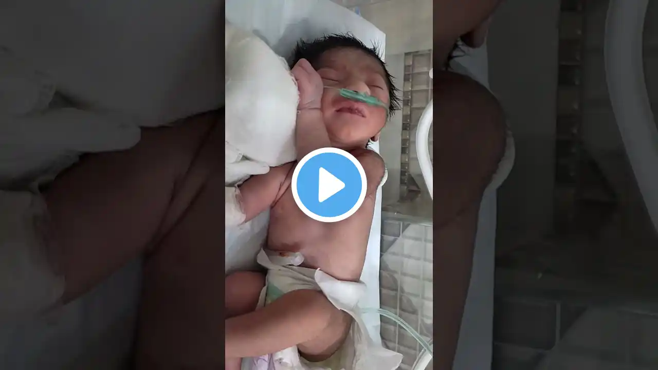 Sleeping Baby in NICU π€π€ #cute #baby #shorts #shortsfeed