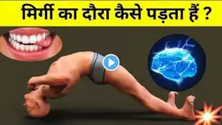 what is seizure|| seizure kyu ata hai||seizure kya hota hai