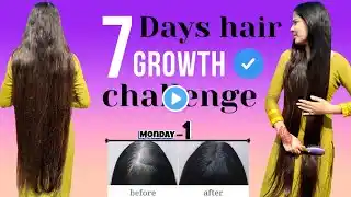 Day-1 |  7 days hair growth challenge | hair growth transformation अब आपके भी बाल होगे मजबूत #hair