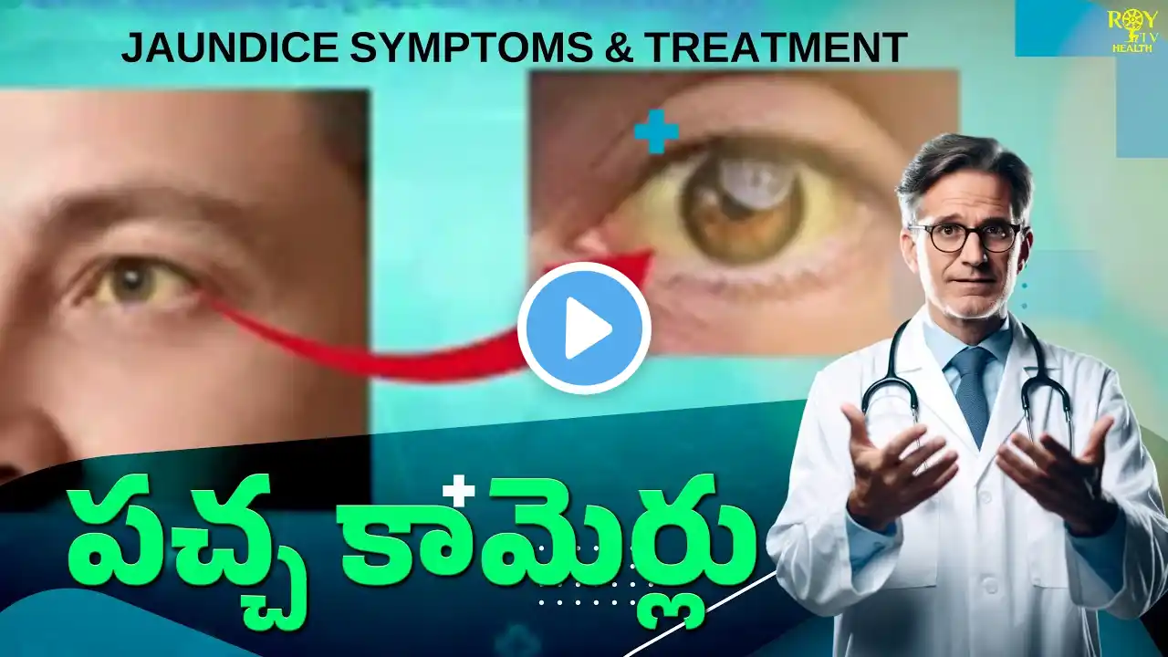 Jaundice Symptoms in Telugu ( పచ్చ కామెర్లు ) Symptoms & Treatment | Health Tips | Roy Tv Health