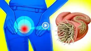 Top 10 Signs You Might Have Parasites