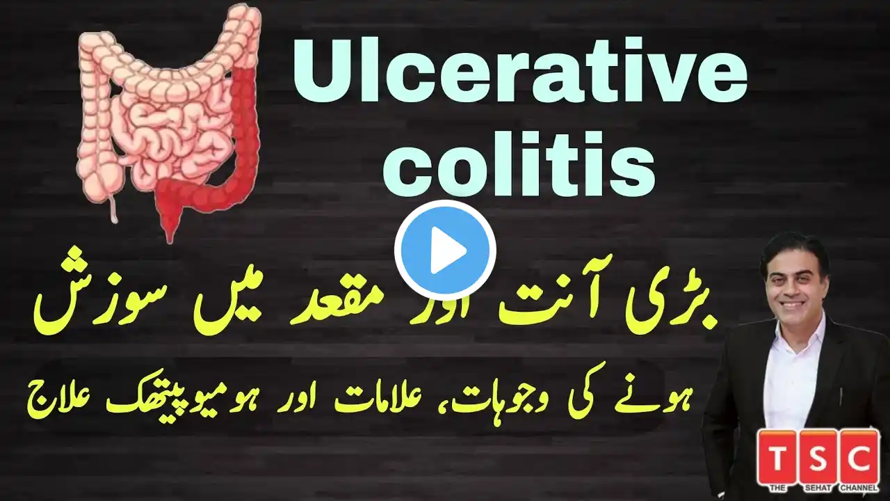 Ulcerative colitis । Colitis |  diarrhea । stomach pain।blood mucus by Adeel mansoor | Urdu | Hindi