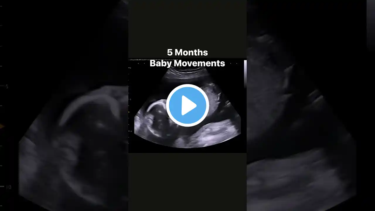 5 month baby movements #jerbearimaging #ultrasound #stephenville #wecometoyou