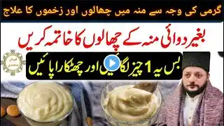 Munh men chale | mouth ulcer | mouth sores treatment | Urdu | Hindi | bayan | Faiz e muhammadi tv