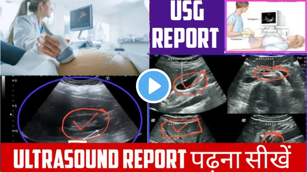 पेट के अल्ट्रासाउंड की रिपोर्ट की जानकारी/USG WHOLE ABDOMEN/ रिपोर्ट में क्या क्या देखते हैं /USG