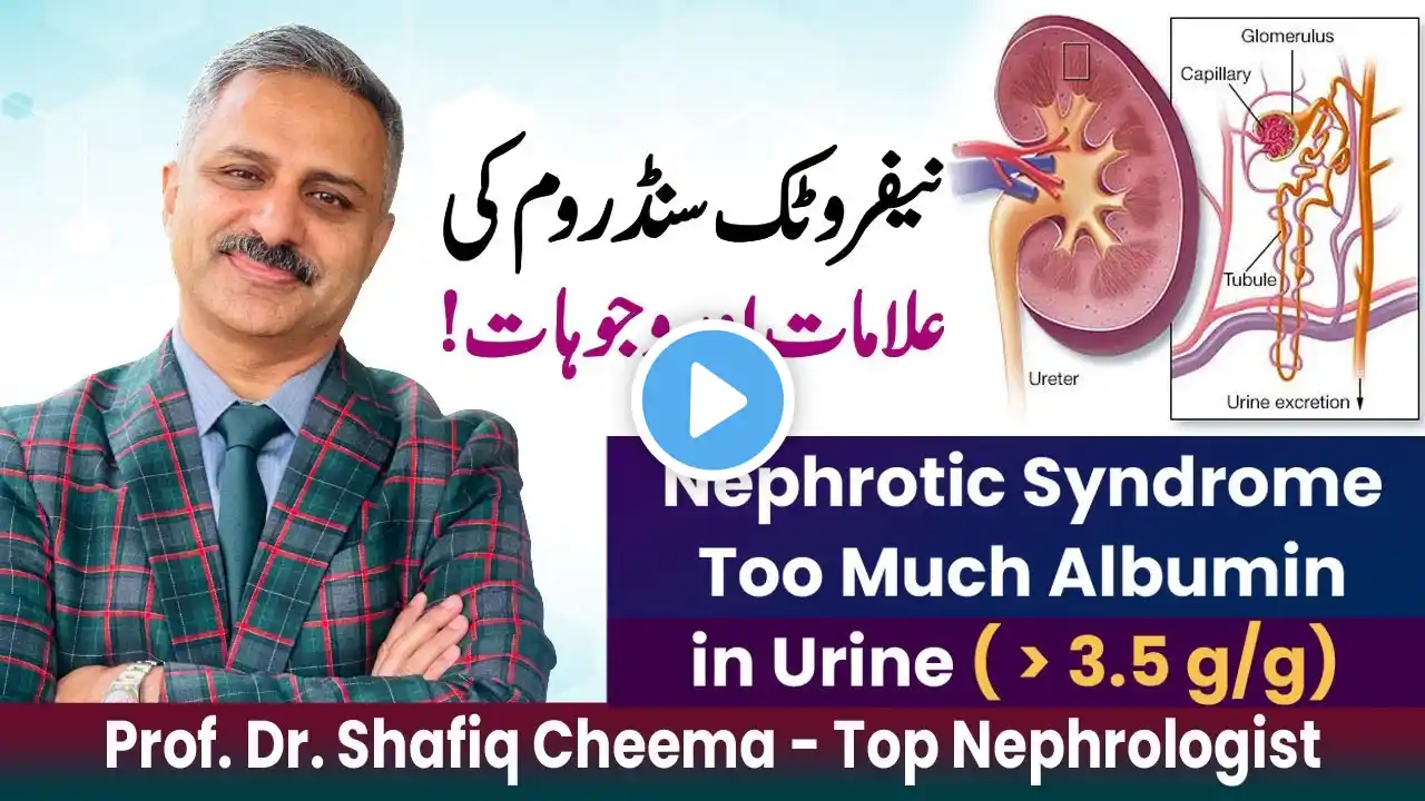 Albuminuria Video 3 : Nephrotic Syndrome or Heavy  Proteinuria | More than 3.5 g/g #proteinuria