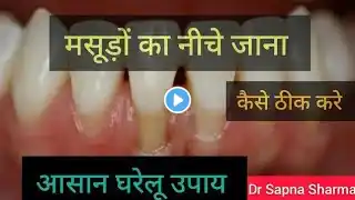 Masudo Ka Niche Jana Kaise Roke   How To Stop Gingival Recession   Home Remedies