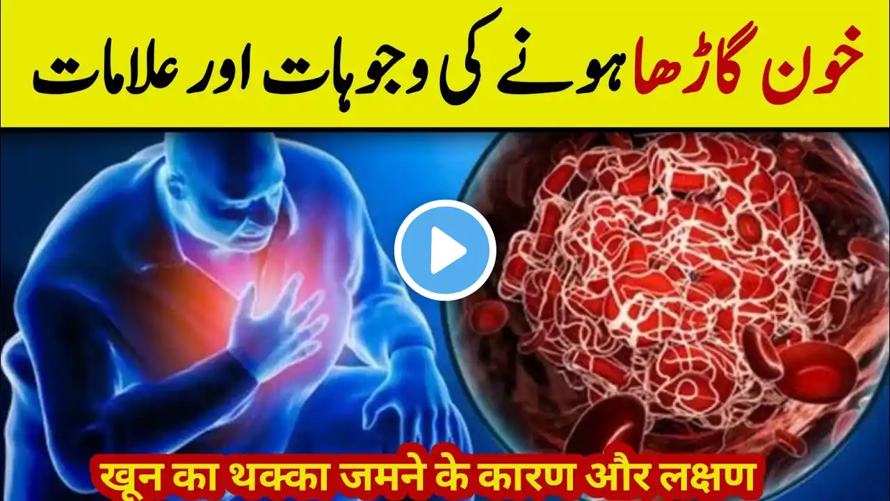 Blood Clot Ka Ilaj - Blood Clot Symptoms In Urdu-Hindi - Dr YK