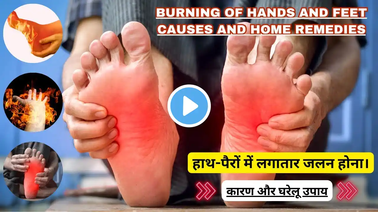 Hath Pair Me Jalan Kyu Hoti Hai | हाथ पैर में जलन होने के कारण | Burning hand And feet causes #video