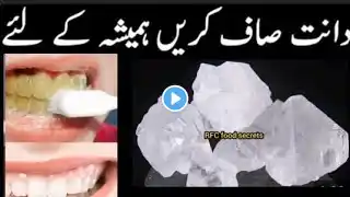 Teeth Cleaning in only 5 Minutes/𝐃𝐈𝐘 𝐓𝐄𝐄𝐓𝐇 𝐖𝐇𝐈𝐓𝐄𝐍𝐈𝐍𝐆 𝐑𝐄𝐌𝐄𝐃𝐘.Dhaanto Ka Dard, Muh Ki Badbu, Dhaanto