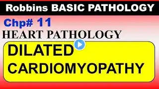 Chp#11 Robbins Patho | Heart Pathology | DILATED Cardiomyopathy | Dr Asif Lectures