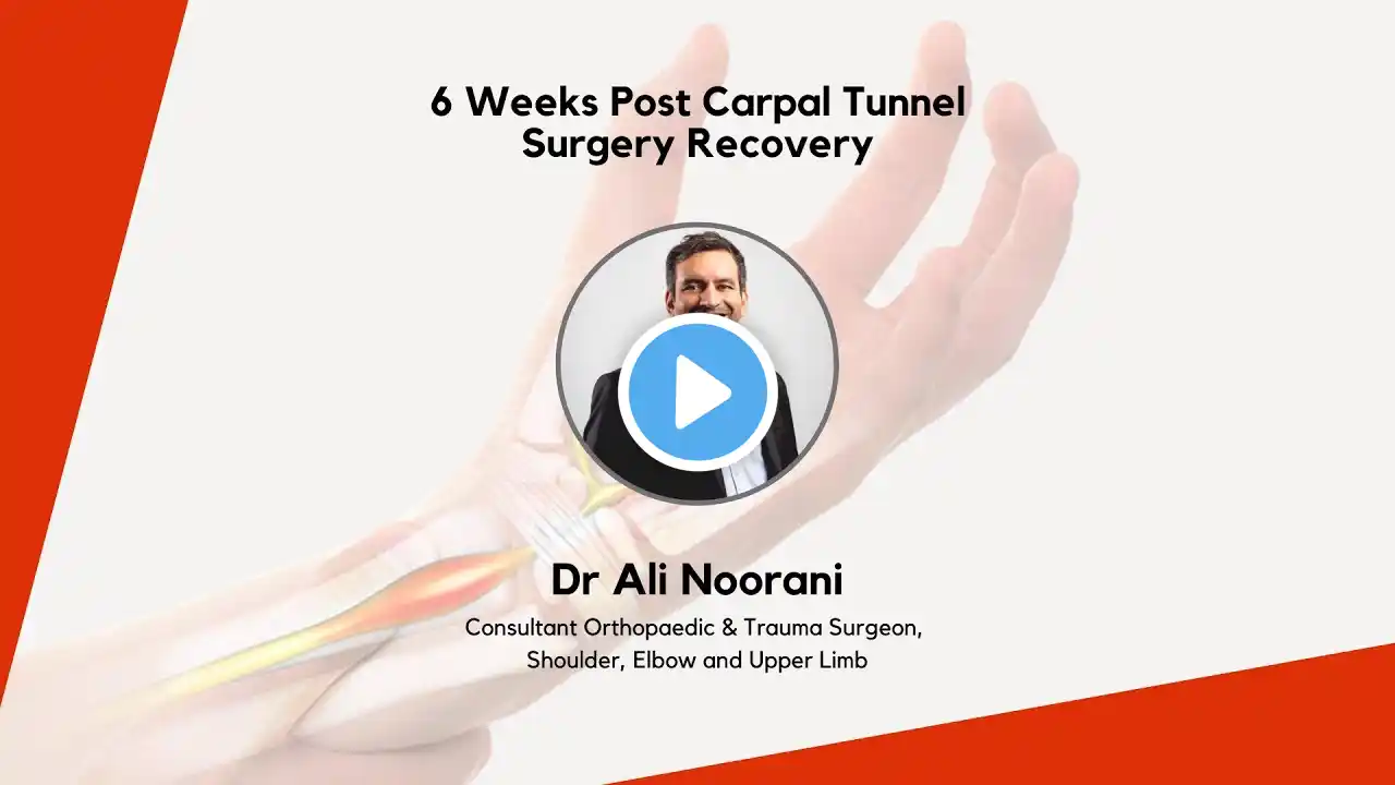 Recovery Of A Patient 6 Weeks Post Surgery For Carpal Tunnel Syndrome - Professor Ali Noorani