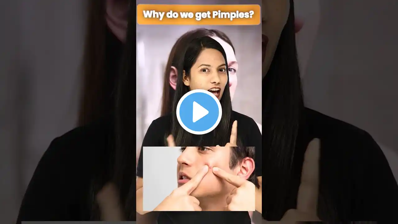 Why do we get Pimples?😟| The Biology behind acne #biology #magnetbrains