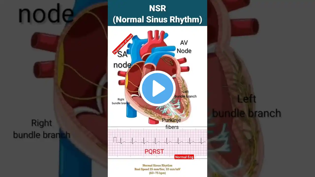 Normal Sinus Rhythm l Electrical system of Heart l #heart #shorts