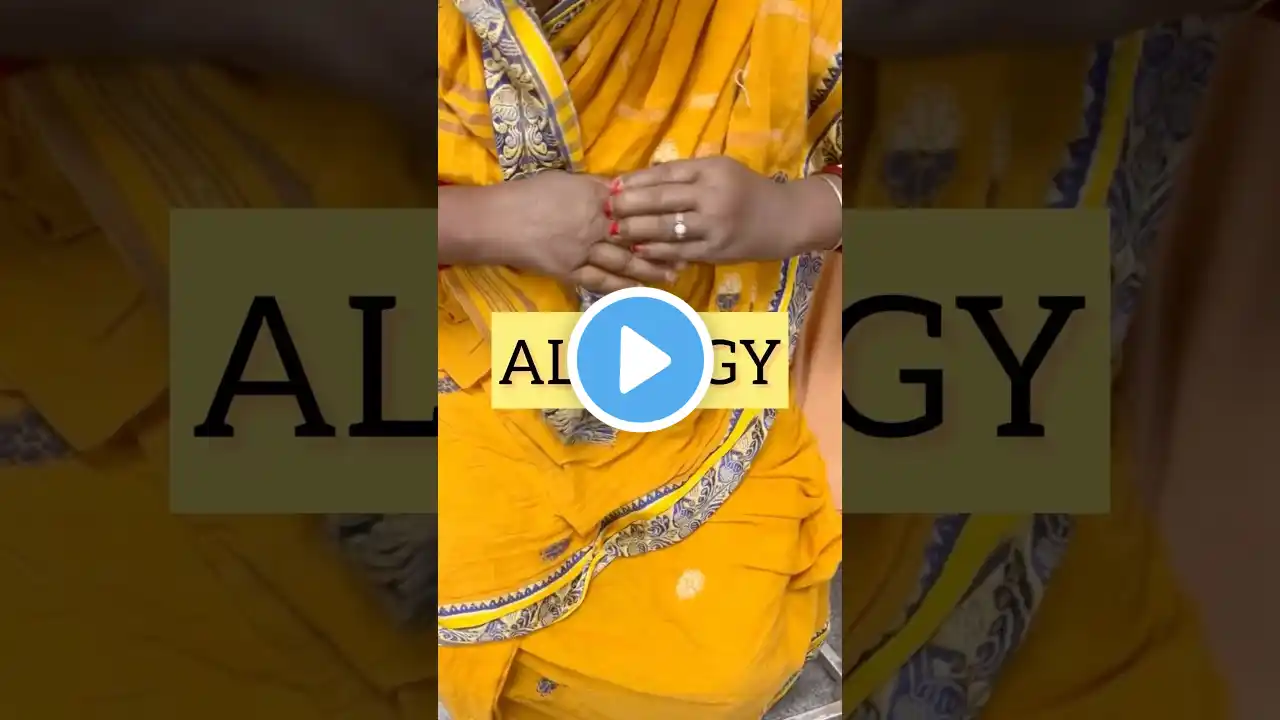 ALLERGY!||How to get cured||Serious😳#allergies #bengaliminivlog #youtubeshorts