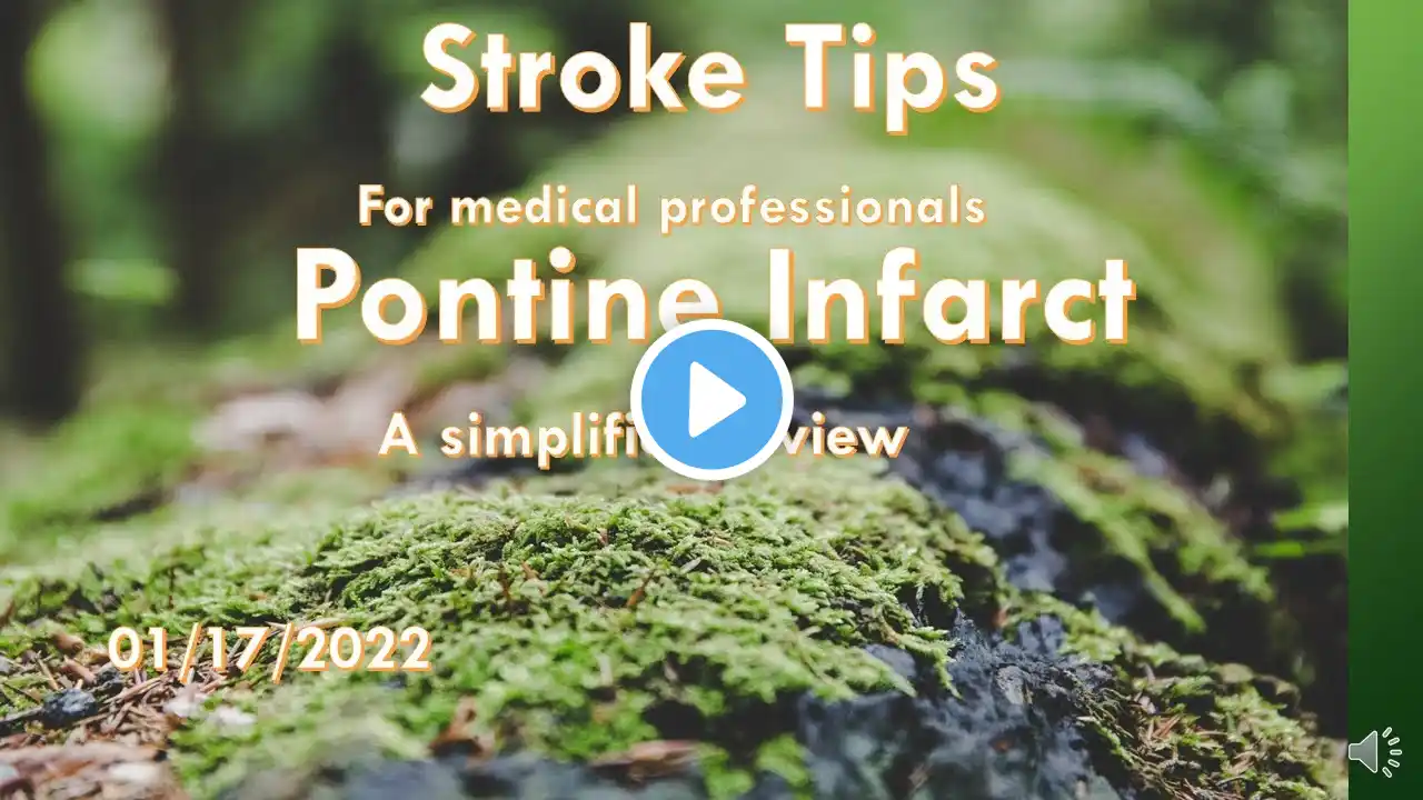 Stroke Tips: Pontine infarct, a simplified review