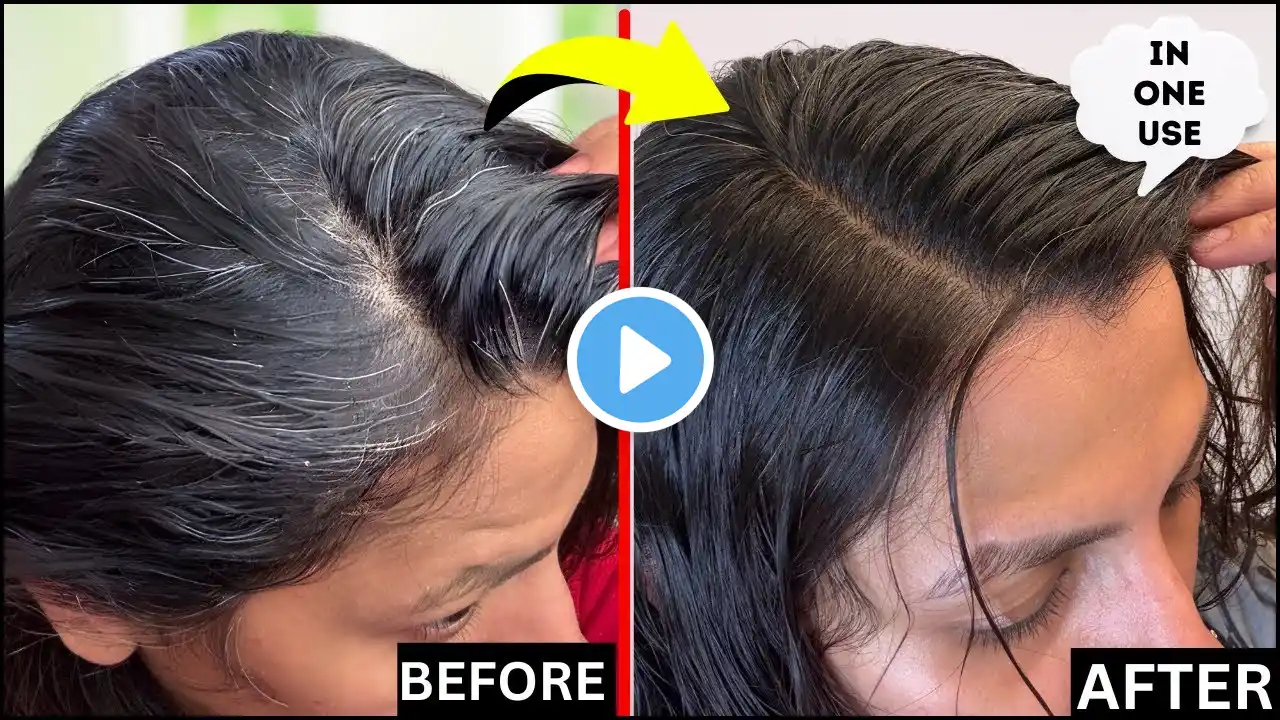 Doctor Reveals FAST HAIR GROWTH Remedy with HENNA & INDIGO  HOW TO COLOR WHITE HAIR BLACK NATURALLY