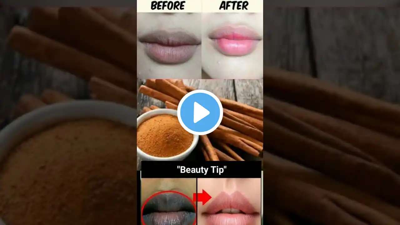 How To Remove Dark Lips In Home🏠Home Remedy ✅WORKS #shorts #trendinghacks #hack #viral #short