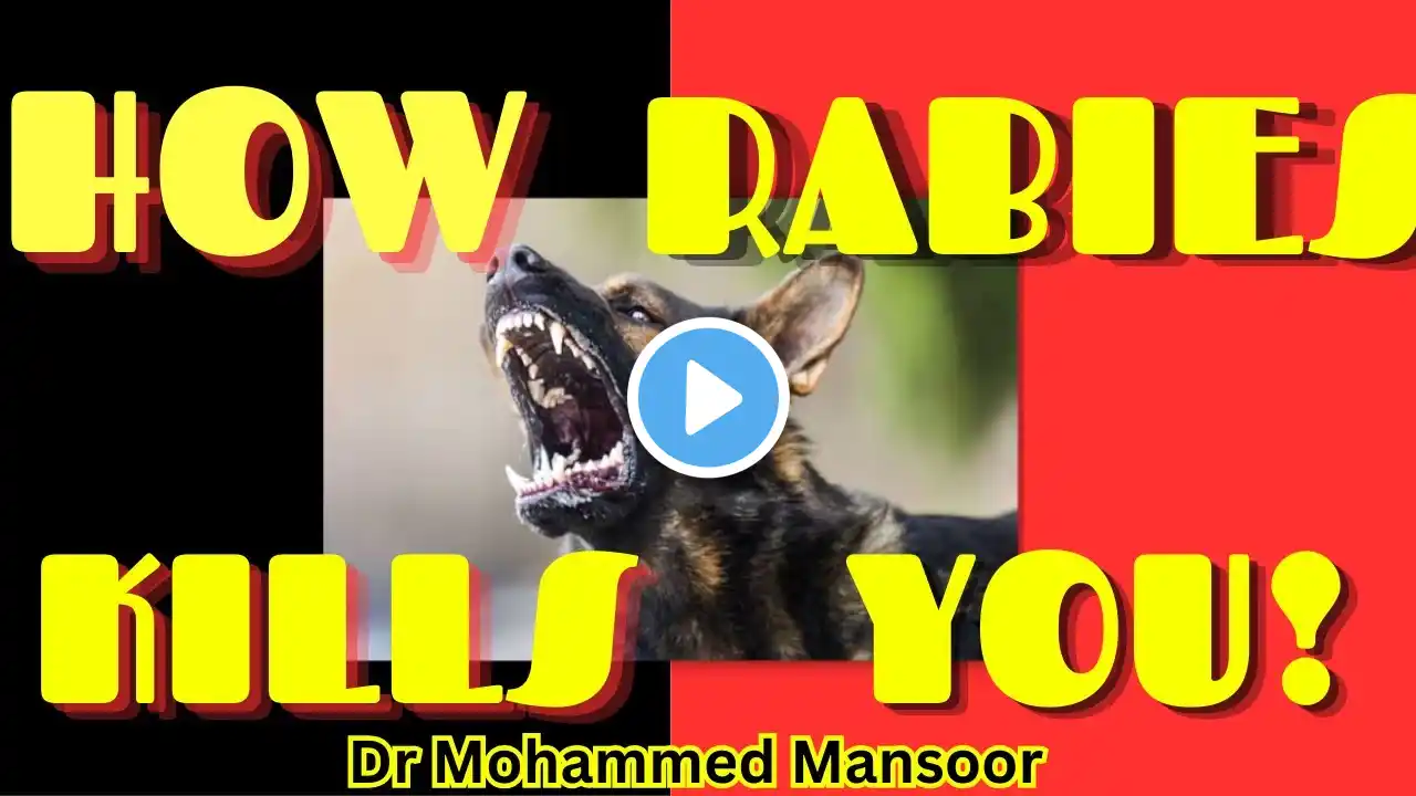 Rabies virus മനുഷ്യനെ കീഴ്പ്പെടുത്തുന്നത് എങ്ങിനെ? How Rabies kills you? Dr Mansoor