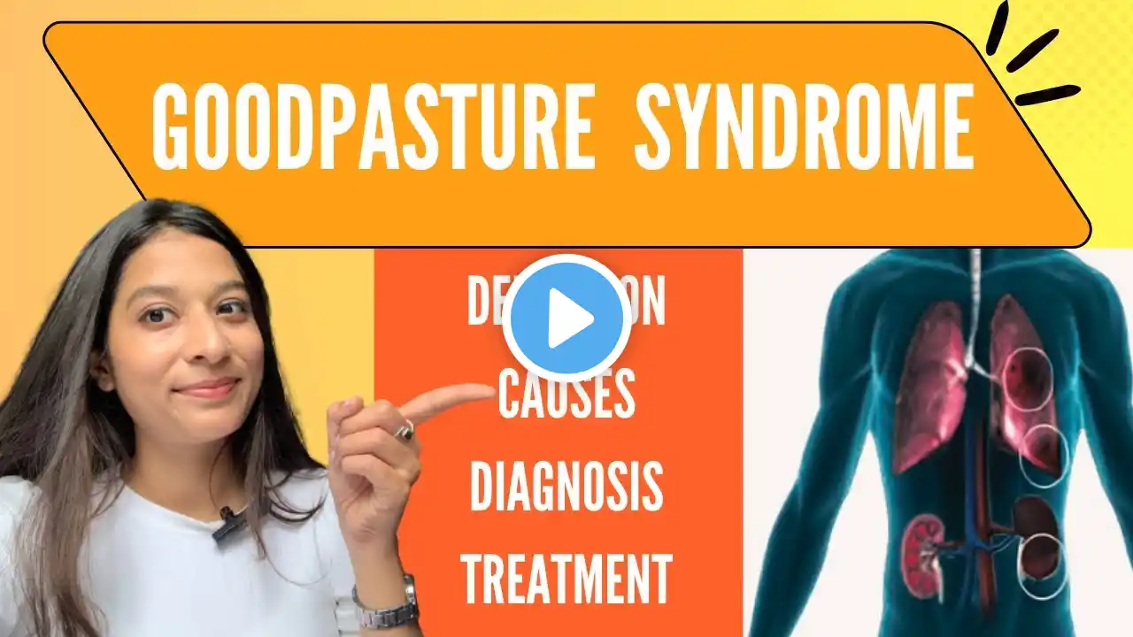 Goodpasture Syndrome Explained Easily in Hindi | Definition, Symptoms, Causes & Treatment